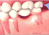 ブリッジ、東京都日野市 インプラント | 日野旭が丘歯科+Kids Dental、日野旭ヶ丘歯科