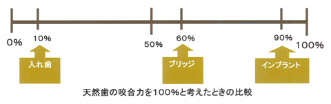 咬合力の違い、東京都日野市 インプラント | 日野旭が丘歯科+Kids Dental、日野旭ヶ丘歯科